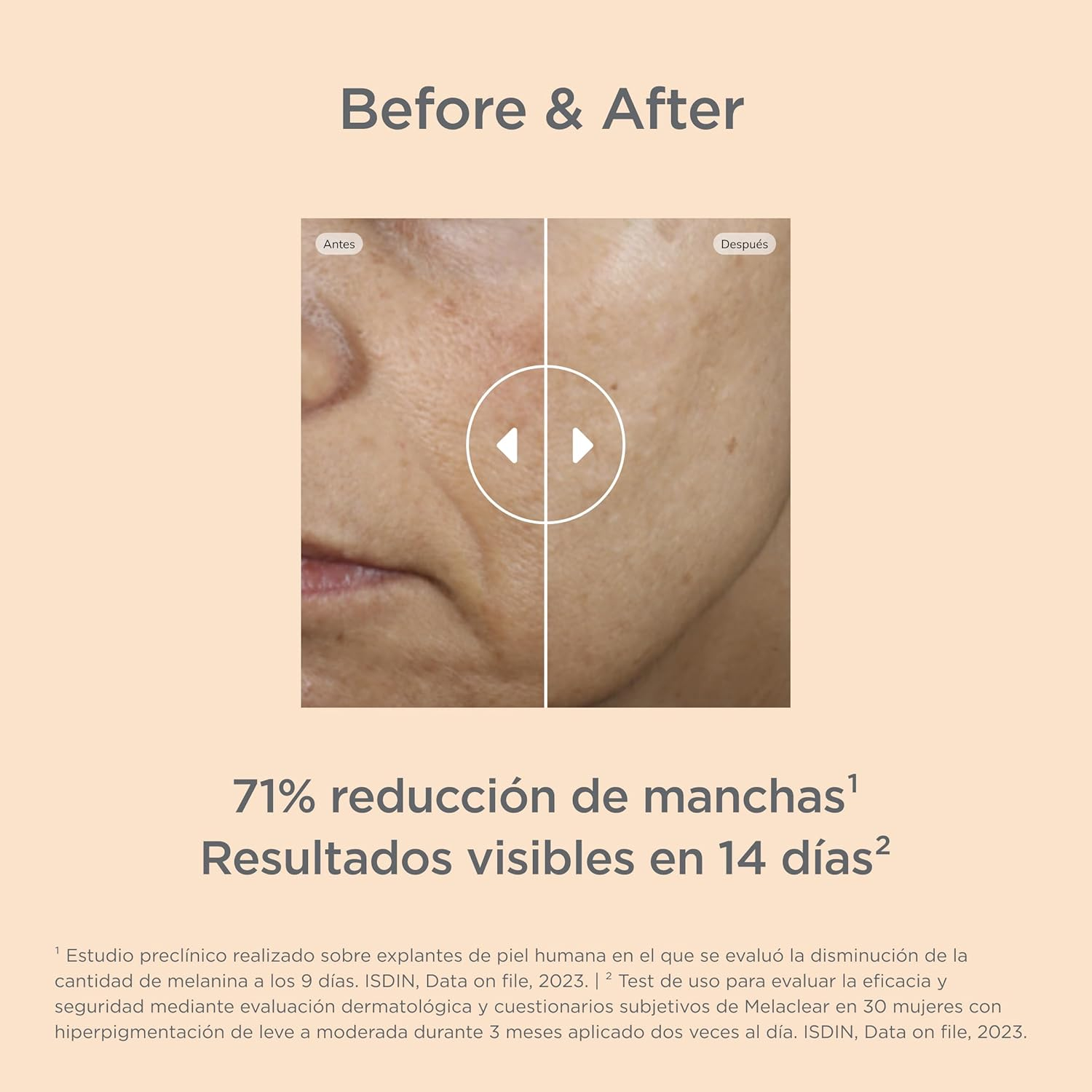 ISIDN Isdinceutics Melaclear Sérum Antimanchas con Ácido Tranexámico y Niacinamida, Reduce las Manchas de la Piel Rápidamente, 1,8% 30 ml - Imagen 9
